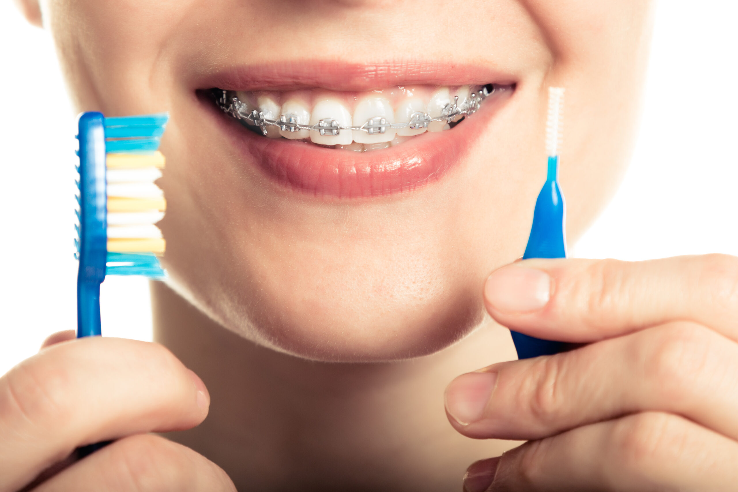 Do your teeth. Гигиена полости рта с брекет системой. Ортодонтическая щетка для брекетов. Гигиена полости рта с брекетами в стоматологии.
